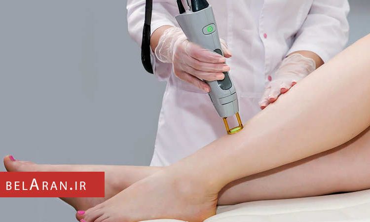 شناخت روش هایی برای رفع دائمی موهای زائد بدن - بلاران