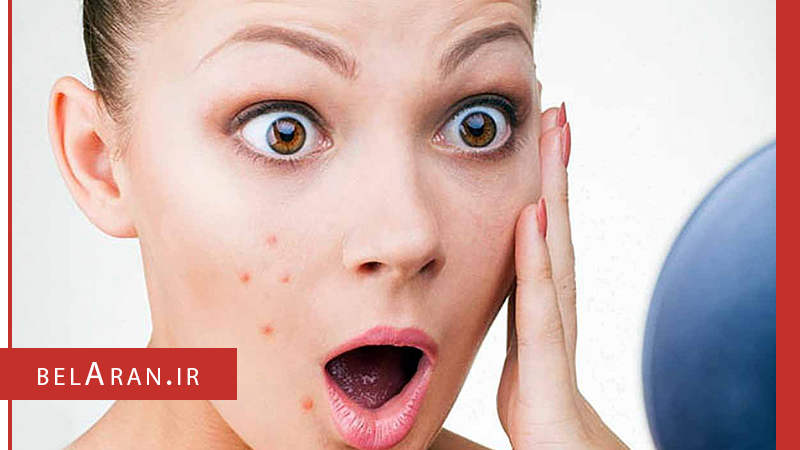 جوش های بعد اصلاح صورت را چگونه درمان کنیم؟ - بلاران