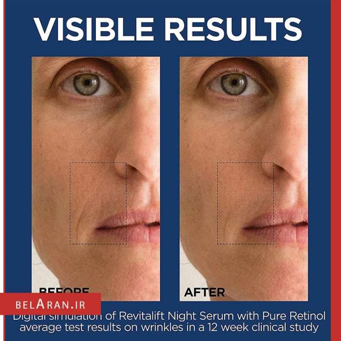سرم شب ضدچروک لورال رویتالیفت لیزر رتینول-بلاران LOreal Revitalift Laser Pure Retinol Deep Anti-Wrinkle Night Serum