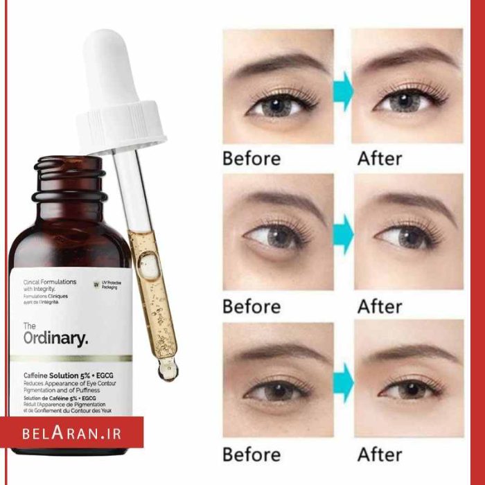 سرم کافئین دور چشم اوردینری روشن کننده و ضد تیرگی و پف دور چشم_بلاران The Ordinary Caffeine Solution 5% + EGCG 30ml