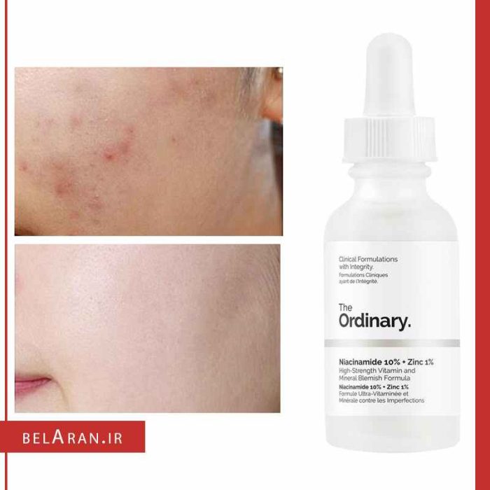 سرم نیاسینامید و زینک اوردینری-بلاران The Ordinary Niacinamide 10% + Zinc 1%
