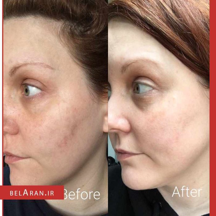سرم ویتامین سی بالانس اکتیو Balance Active Formula Vitamin C Brightening Serum