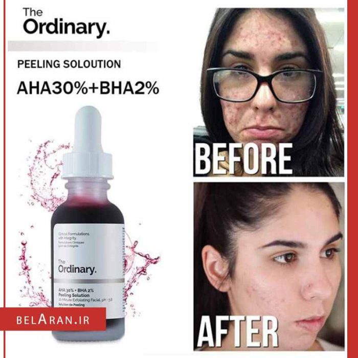سرم پیلینگ و لایه بردار اوردینری-بلاران The Ordinary AHA 30%+BHA 2% Peeling Solution Serum