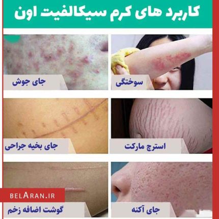 کرم ترمیم کننده پوست سیکالفیت پلاس اون-بلاران AVENE Cicalfate+ Repairing Protective Cream