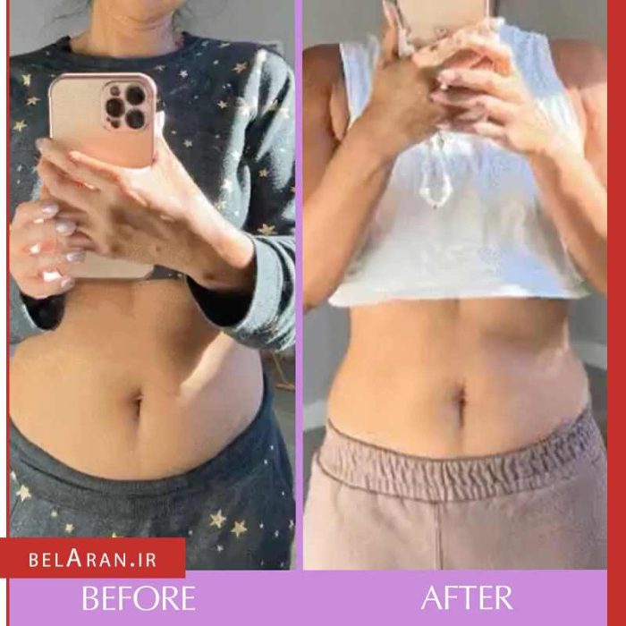 کپسول گیاهی مکمل لاغری بلوتامین هیرتامین-خرید لوازم آرایش اورجینال بلاران Hairtamin Bloatamin Digestive Health Capsule